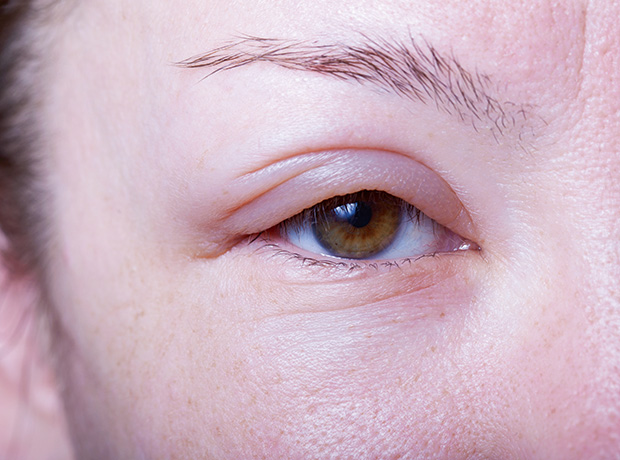 MHRA clarifies position on off-label Avastin